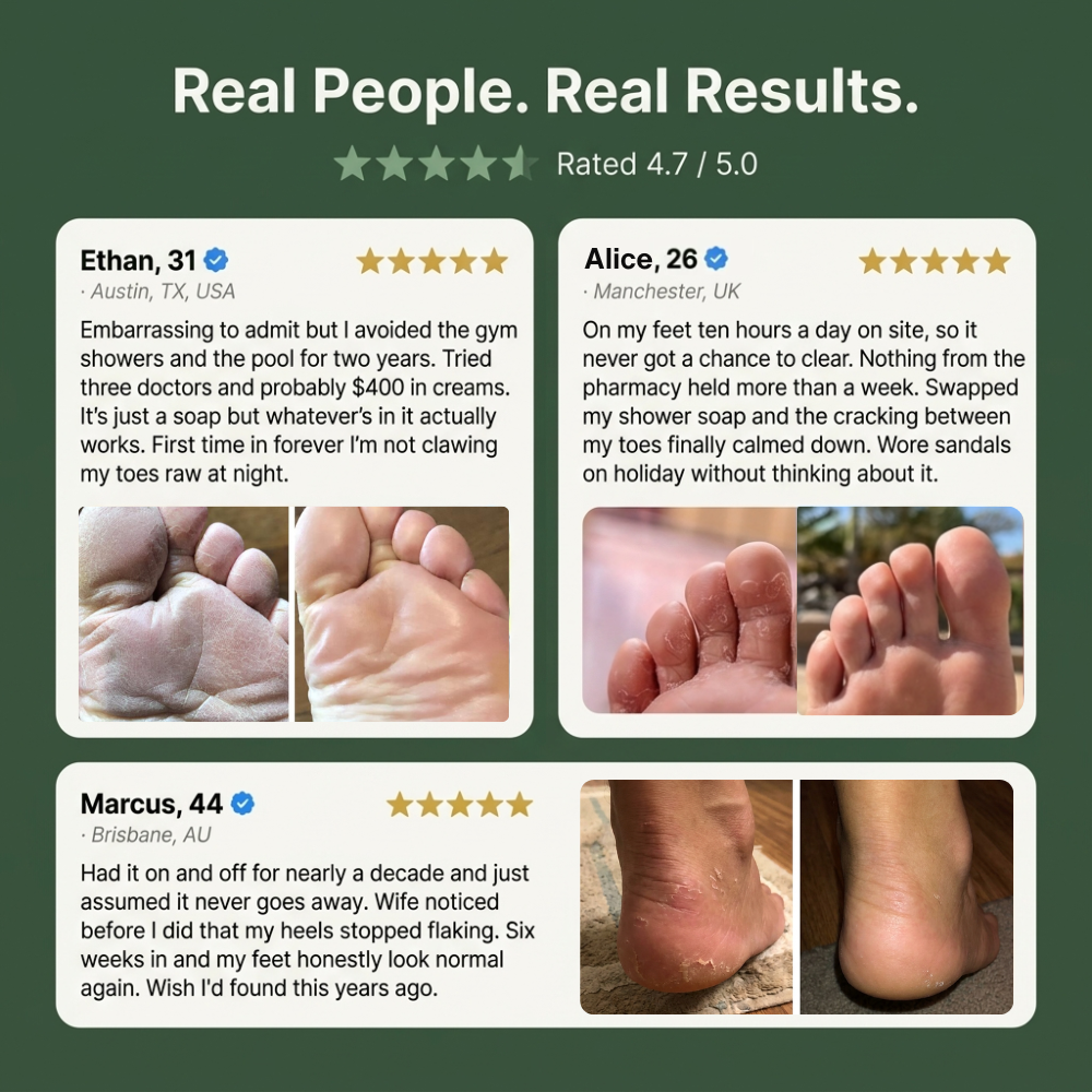 Antifungal Soap