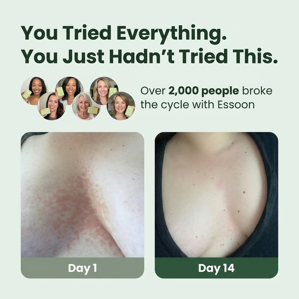 Antifungal Soap