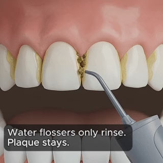 Water flossers only rinse. Plaque stays. Essoon uses real floss.